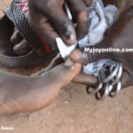 Several Ghanaians at risk as roving Pedicurists spread infections