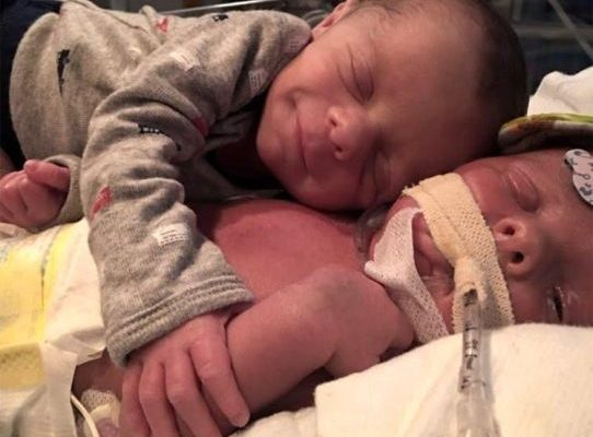Heartbreaking picture of newborn baby saying goodbye to his twin