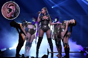 Beyonce rips her earlobe open at Tidal concert
