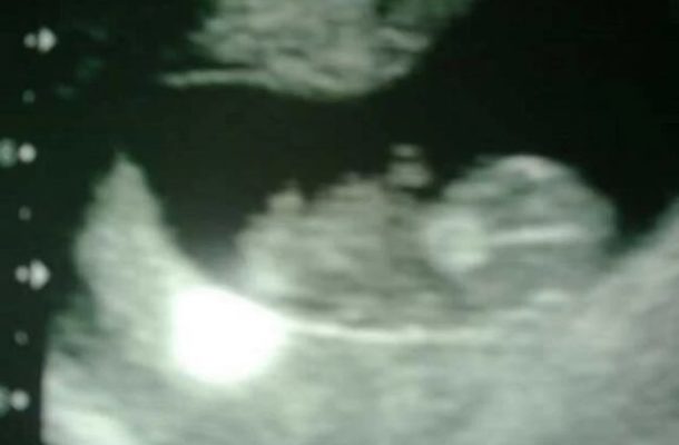 DJ shocked after ultrasound showed his baby ‘wearing tiny headphones’