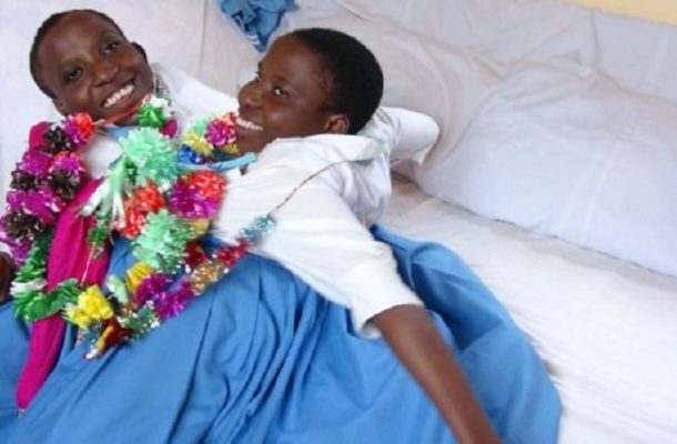 Tanzanian Conjoined Twins Maria And Consolata Die Aged 21