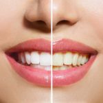 Dentist reveals the surprising foods that are secretly RUINING your teeth