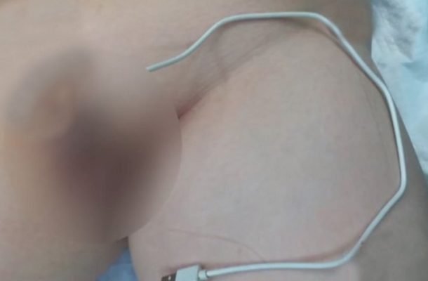 ‘Curious’ boy, 13, gets USB cable stuck up his penis