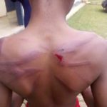 14-year-old boy given 36 lashes by Police for ‘Insubordination’