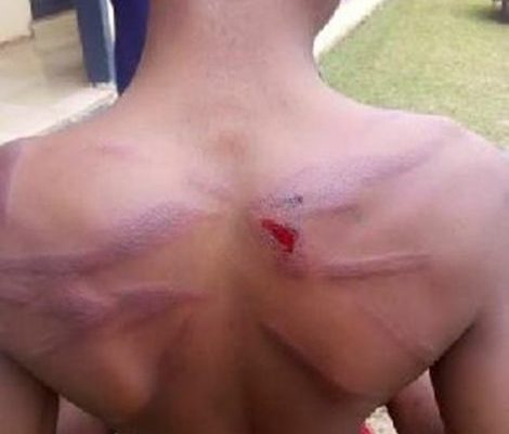 14-year-old boy given 36 lashes by Police for ‘Insubordination’