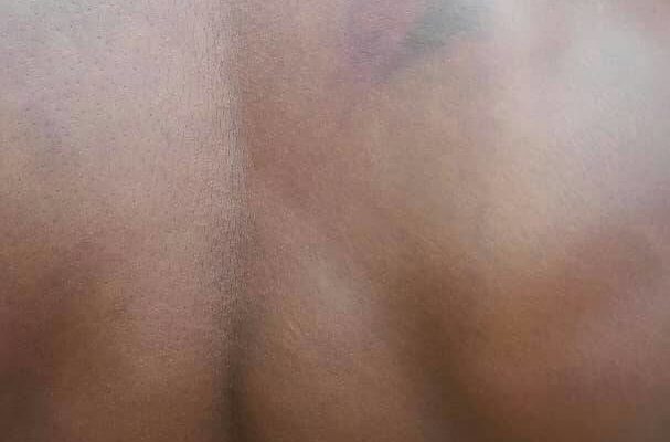 Man flogged mercilessly by highway patrol team