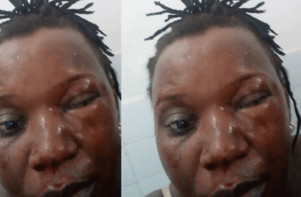 Married man beats #sidechick to a pulp