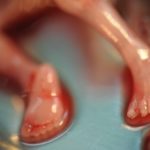 Doctor performs abortion on the wrong woman