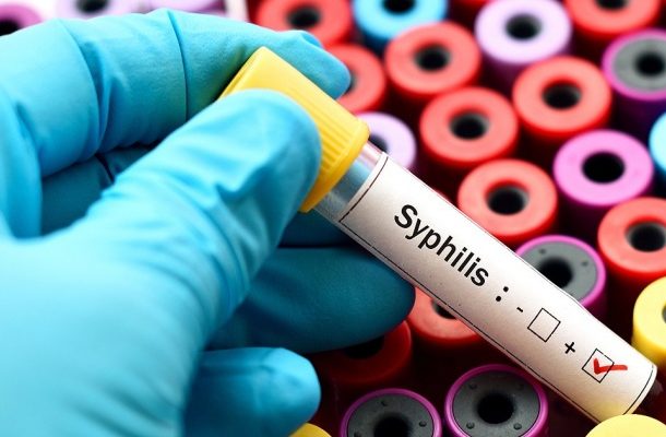 A young person is diagnosed with an STD every four minutes - REPORT