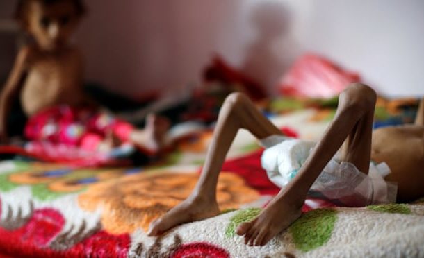 Yemen on brink of 'world's worst famine in 100 years' if war continues
