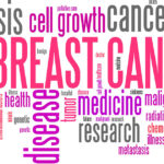 Breast cancer the commonest cancer type affecting women in Ghana, Nigeria