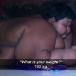 Video: Interesting!!, Know the Most Obese Boy and His illness.
