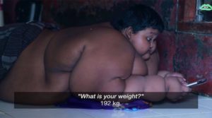 Video: Interesting!!, Know the Most Obese Boy and His illness.