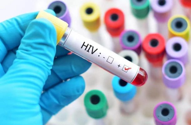 Over 19,000 Ghanaians tested positive for HIV in 2017 – Ghana AIDS Commission