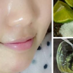 How to use lemon to remove the spots from your face