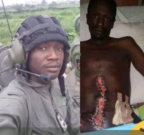 PHOTOS: Soldier in critical condition after hospital carries out wrong surgery on him