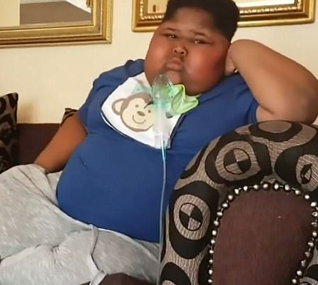 SAD: Obese boy who went viral due to a rare condition that makes him eat all the time dies at 11