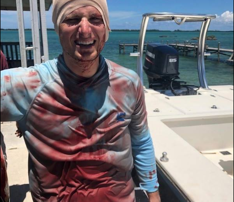 VIDEO: Shocking moment a man was bitten on the head by a shark but he survives