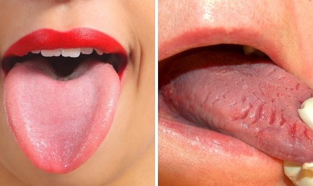 Your health will be manifested through 9 signs from your tongue