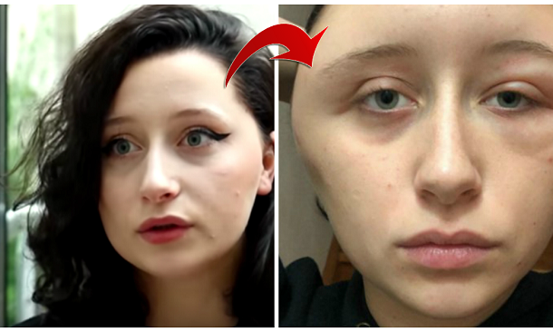 SHOCKER: Horrific reaction to a hair dye makes woman's head double in size