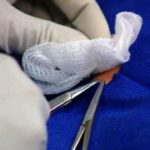 Toddler dies in circumcision in Italy