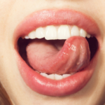 What is the colour of your tongue? - The surprising fact the colour of your tongue tells about your health!