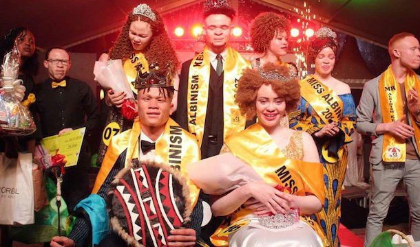 Mr and Miss Albinism East Africa 2018 crowned