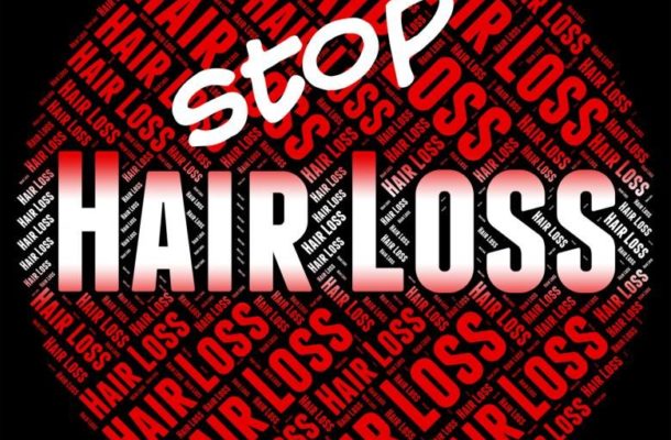 Top 5 treatments for hair loss