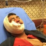 Israeli troops injure 2 Palestinians near Joseph's Tomb