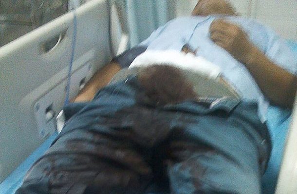 TRAGIC: 25-year-old man chops off his penis after getting drunk
