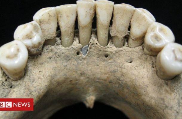 Blue tooth reveals hidden medieval artist