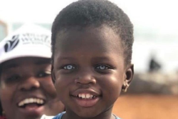 Blue-eyed Ghanaian child undergoes successful operation in South Africa