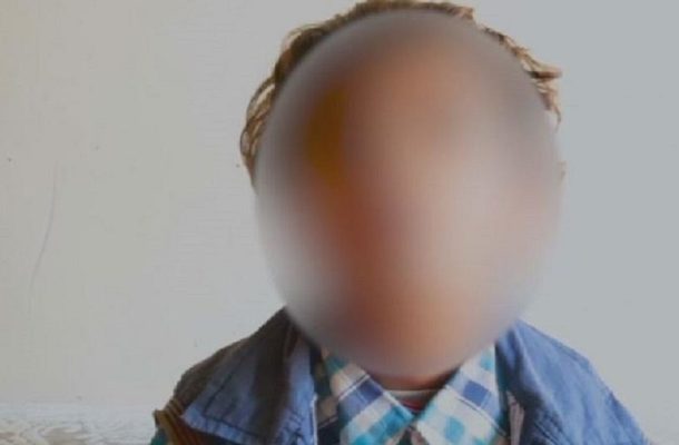 Yemeni war: 8-year-old boy left partially blind