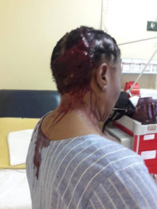 SHOCKING PHOTOS: Teacher hospitalised after irate parent beat her with umbrella