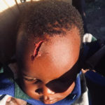 SHOCKING PHOTOS: House help smashes child’s head with glass plate, sprinkles salt on wound and flees