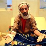 Yemen's healthcare system among war's wreckage
