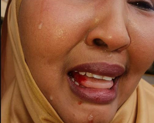 SHOCKER: Female MP arrested for beating female counterpart in parliament