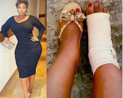 PHOTO: Heavily endowed media personality, Peace Hyde suffers grade 3 ligament tear