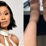 PHOTO: Cardi B shares shocking picture of her massively swollen feet caused by 'cosmetic surgeries'