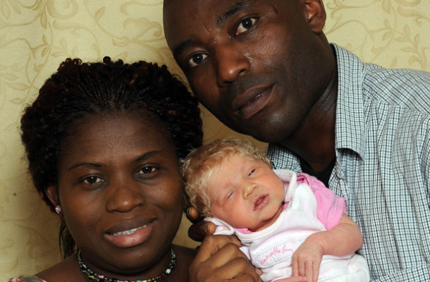SHOCKER: Black parents give birth to white baby