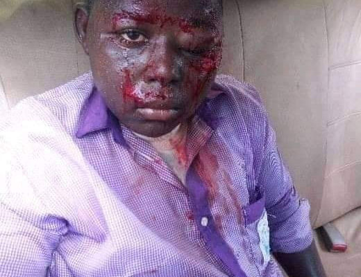 BLOODY: SHS student brutally beaten by teacher