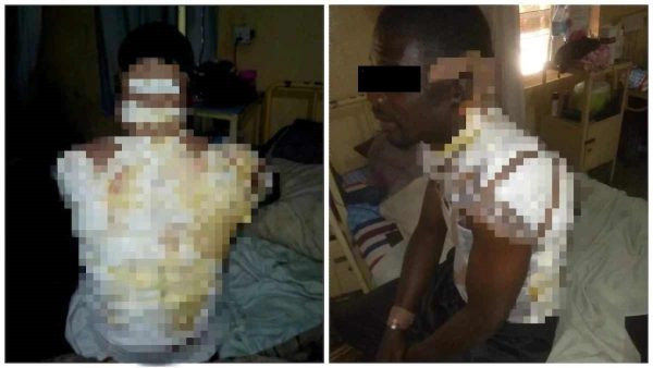 HORRIFIC: Woman pours hot water on husband over second wife plans