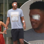 PHOTOS: Love Island star goes blind in one eye after being hit by a champagne cork in Ibiza