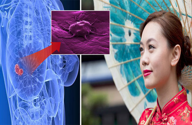 Why women in China don’t get breast cancer REVEALED