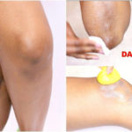 How to get rid of dark elbows and knees naturally