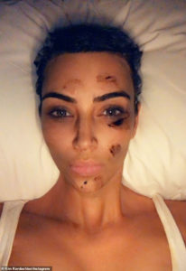 PHOTOS: 'This year psoriasis covered my whole face' - Kim Kardashian reveals her struggles with diseases