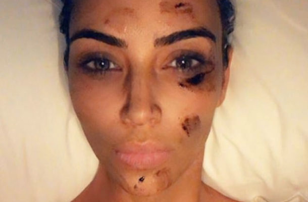 PHOTOS: 'This year psoriasis covered my whole face' - Kim Kardashian reveals her struggles with diseases
