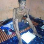 SHOCKING PHOTOS: Uni. Student reduced to bones after overthrowing Jesus to fast for 41 days and nights