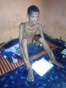 SHOCKING PHOTOS: Uni. Student reduced to bones after overthrowing Jesus to fast for 41 days and nights