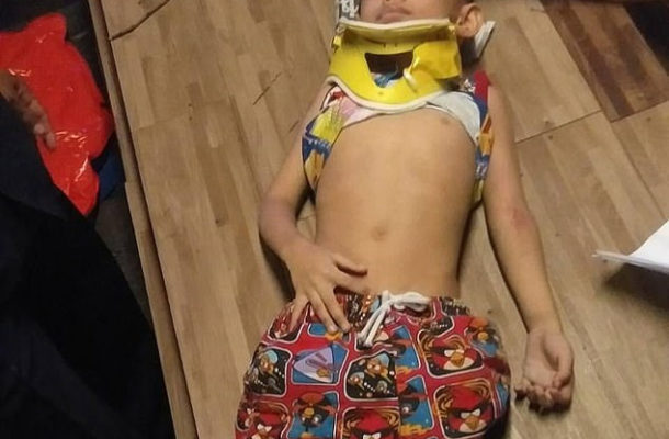 4 yr old boy miraculously survives after plunging 100ft off a balcony